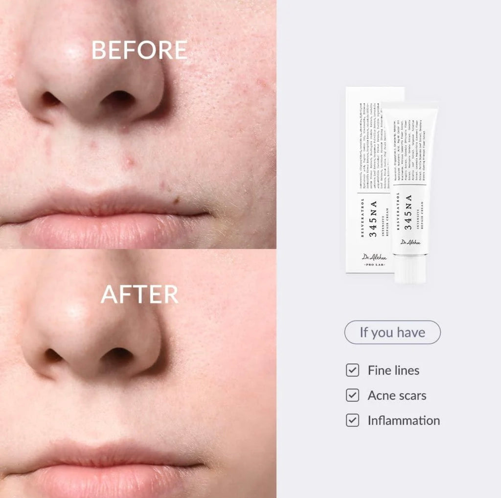 Dr.Althea 345 Relief Cream (100% imported)
