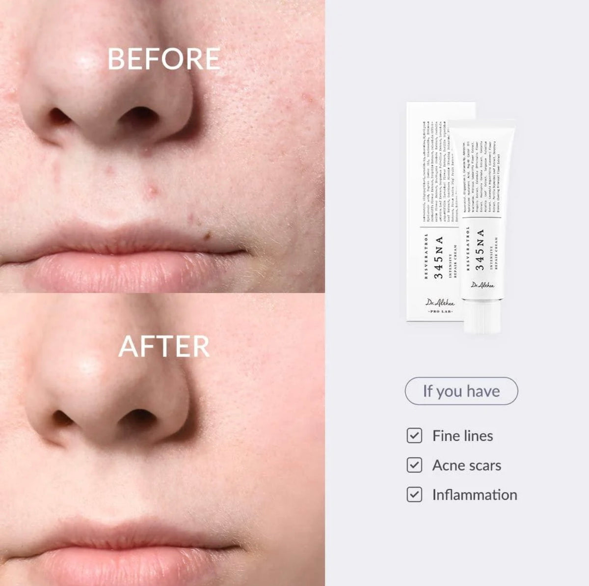 Dr.Althea 345 Relief Cream (100% imported)
